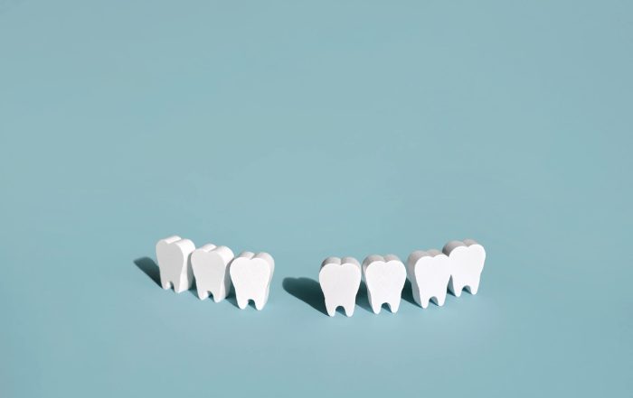 no reponer los dientes perdidos